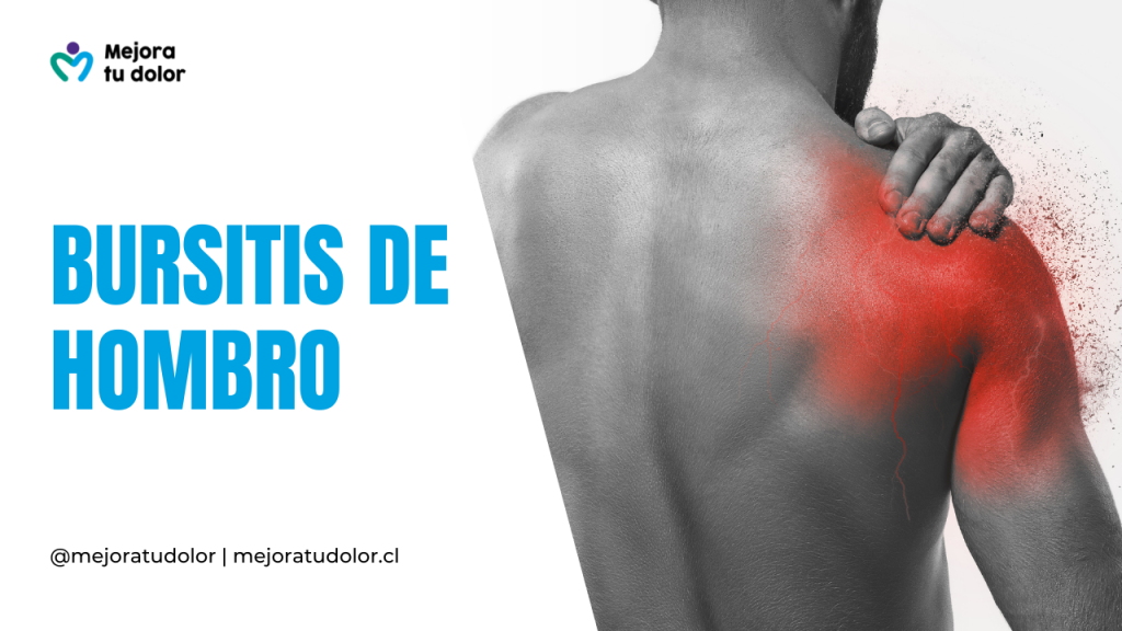 Bursitis de hombro: Te explicamos los síntomas, causas y tratamiento de este dolor crónico