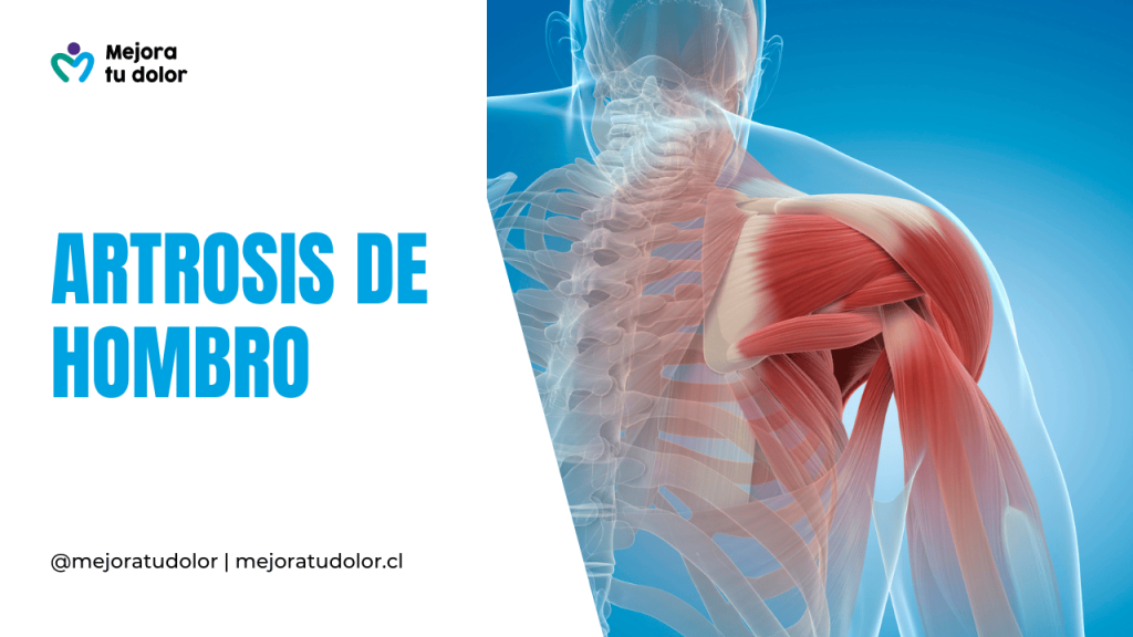 Desgaste en la articulación: Cuando aparece la artrosis de hombro